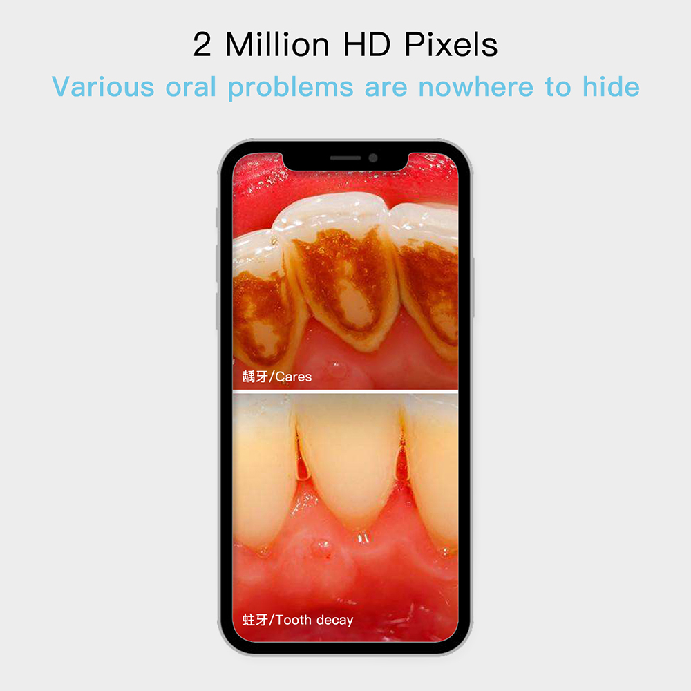 كاميرا أسنان كاملة hd عن طريق الفم